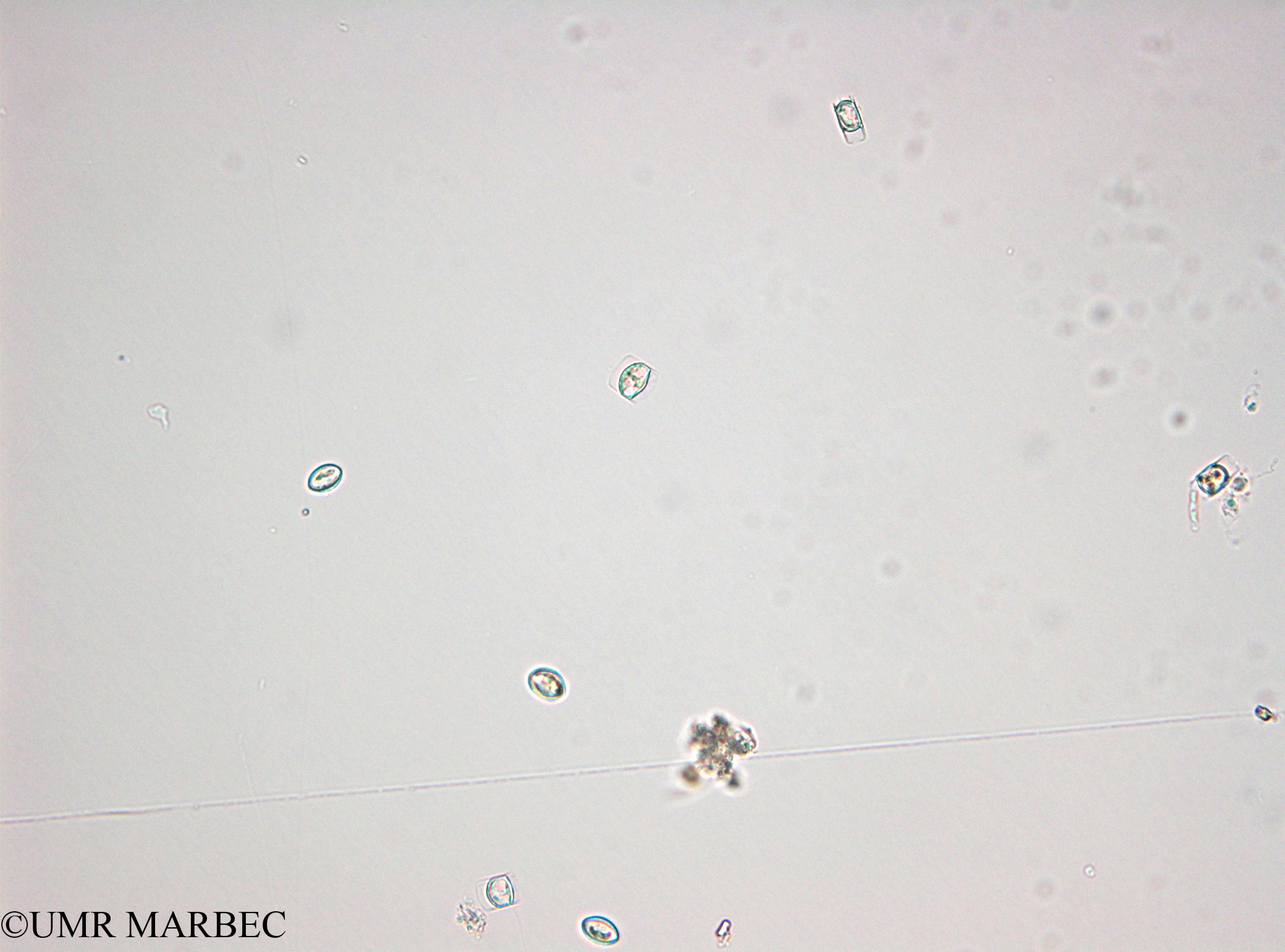 phyto/Thau_Lagoon/THAU_station1/OSU_plancton 2013/Chaetoceros spp (Hypnospores -40x -140211 -5)(copy).jpg